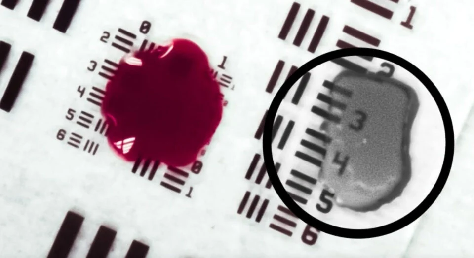 Esta tecnología experimental permite a los cirujanos ver a través de la sangre
